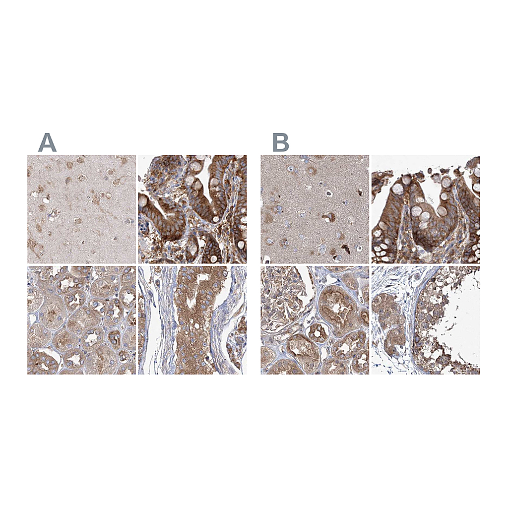 Atlas Antibodies Anti-EIF3A Antibody