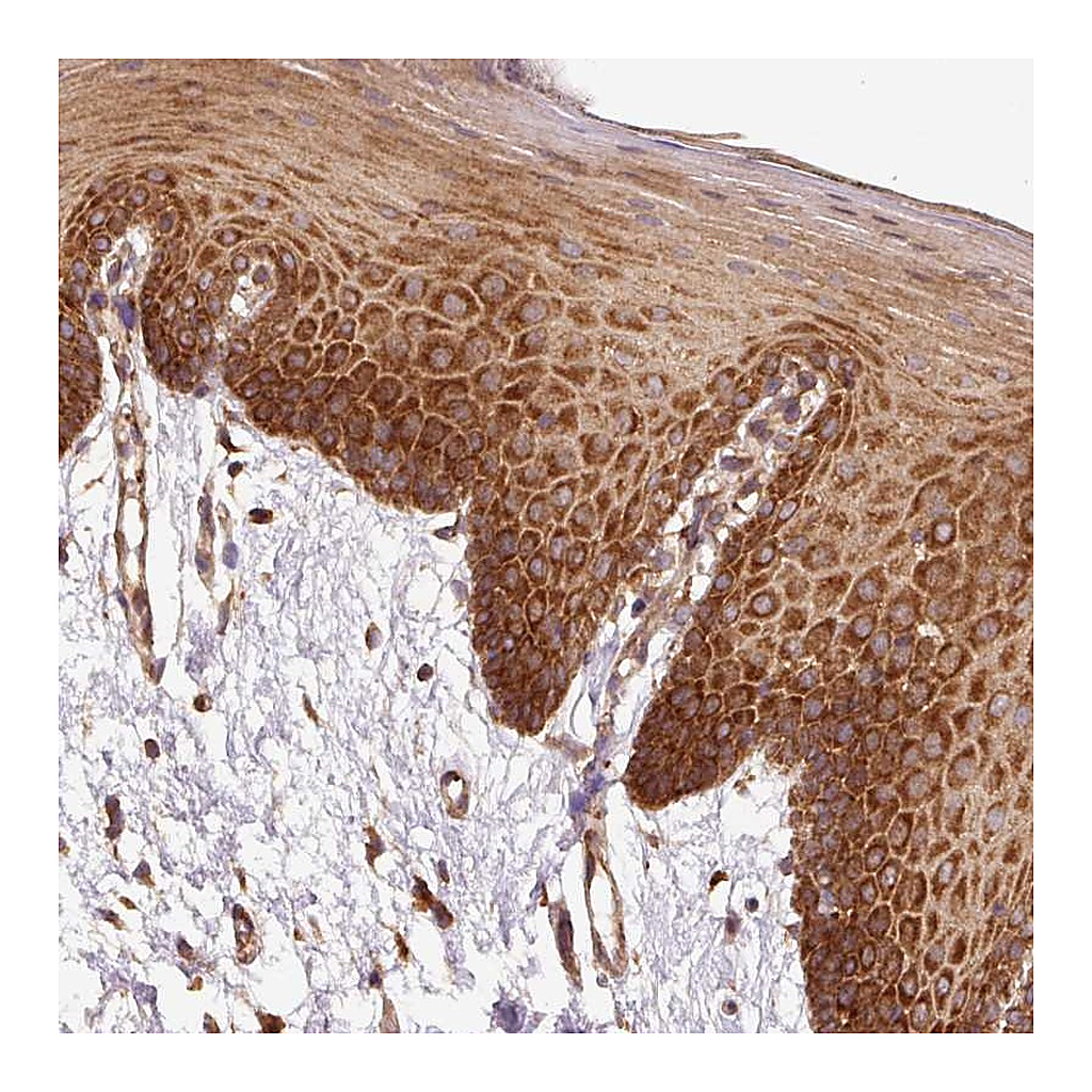 Atlas Antibodies Anti-EIF2S2 Antibody