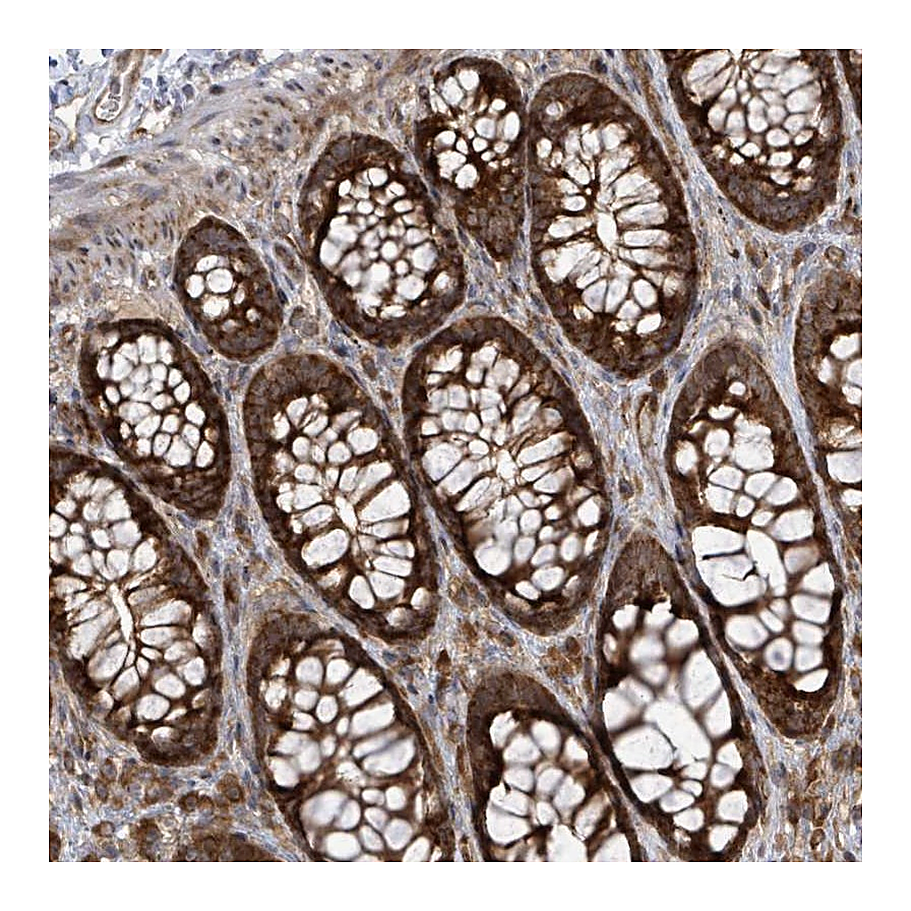 Atlas Antibodies Anti-EIF3C Antibody