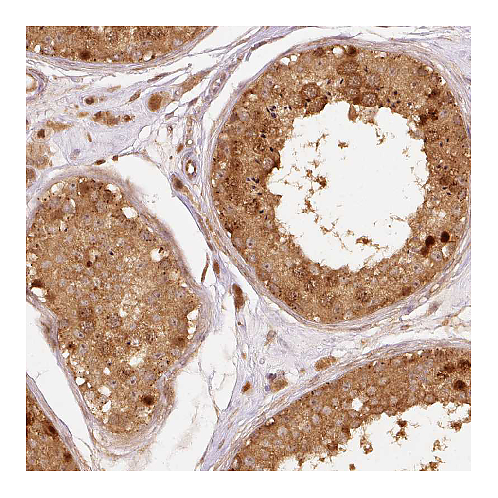 Atlas Antibodies Anti-EIF3B Antibody