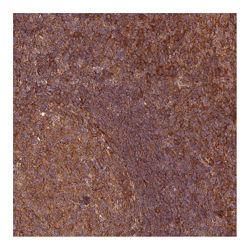 Atlas Antibodies Anti-EIF3D Antibody