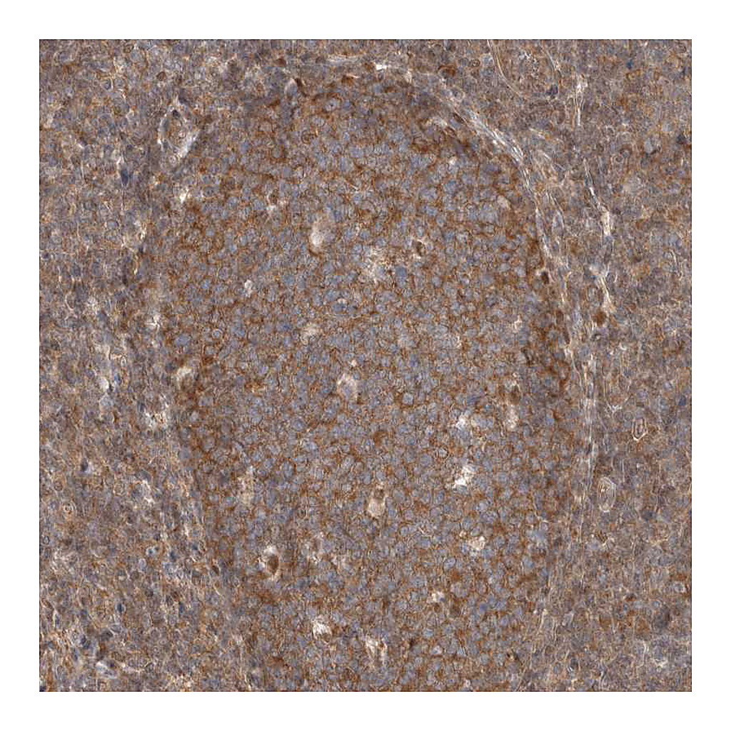 Atlas Antibodies Anti-EIF3E Antibody