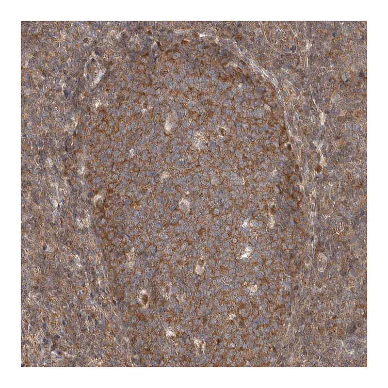 Atlas Antibodies Anti-EIF3E Antibody