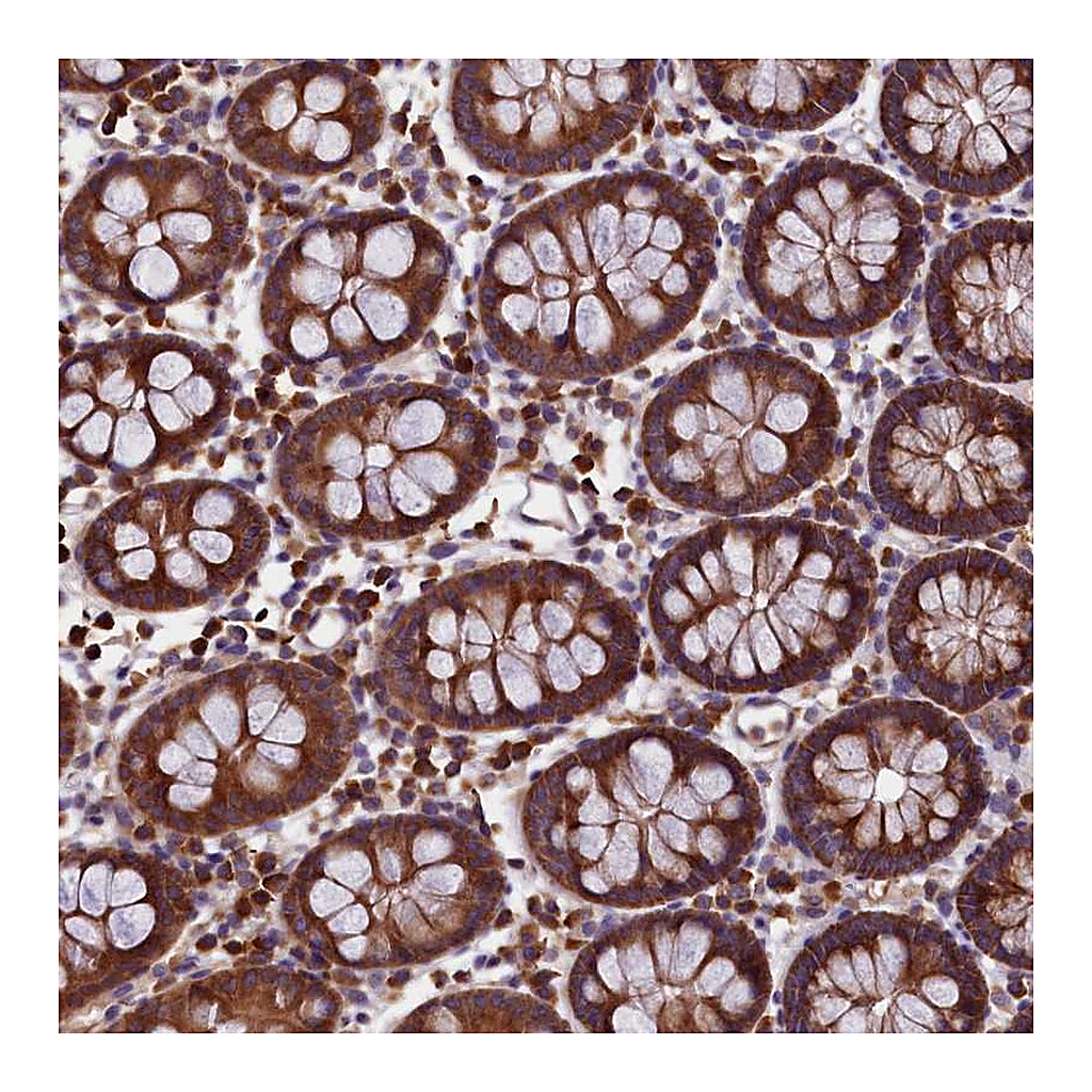 Atlas Antibodies Anti-EIF3G Antibody