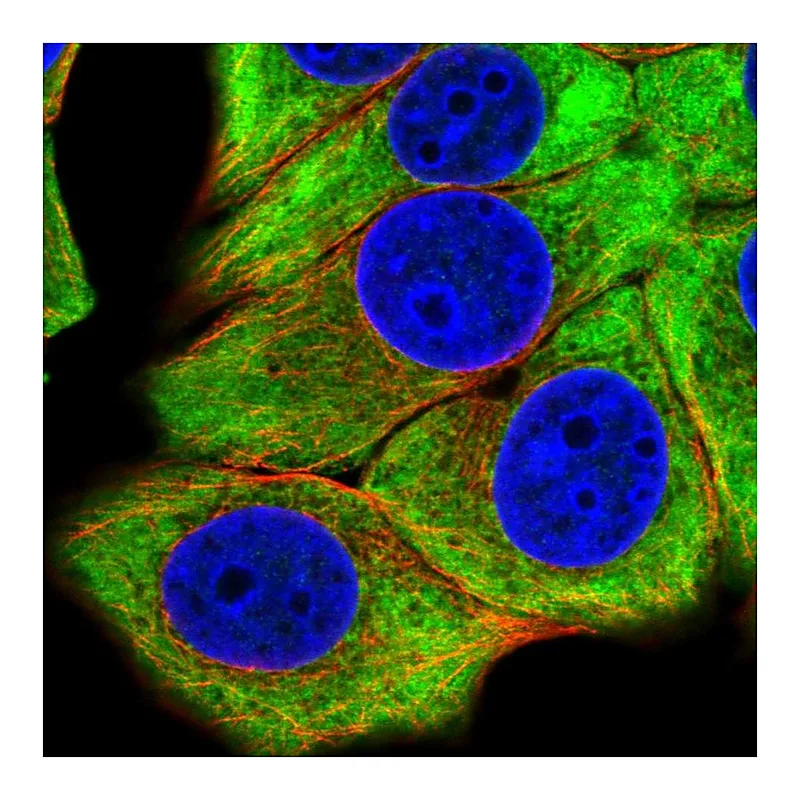 Atlas Antibodies Anti-EIF4B Antibody