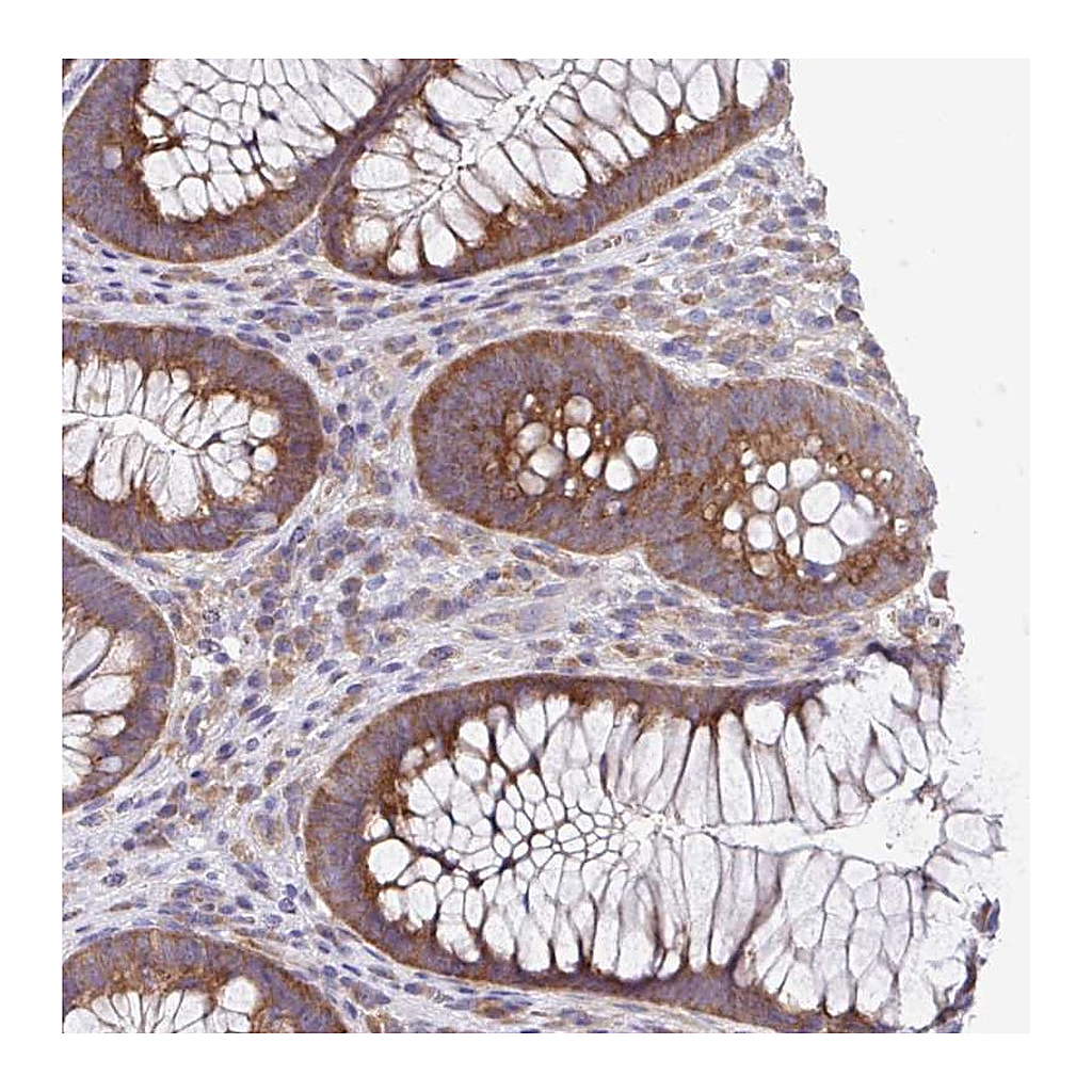 Atlas Antibodies Anti-EIF4B Antibody