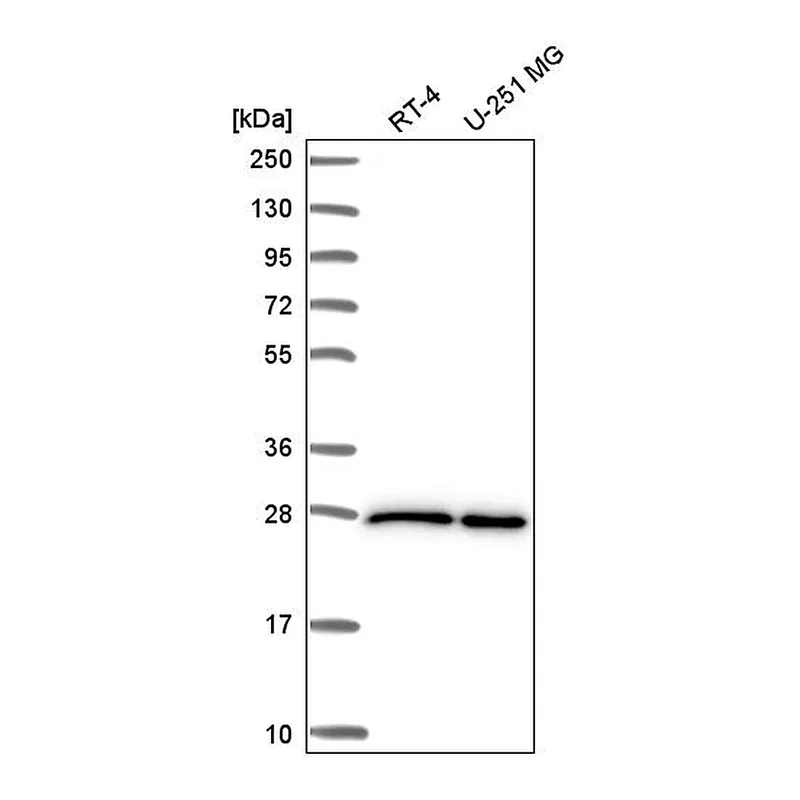 Atlas Antibodies Anti-EIF4E Antibody