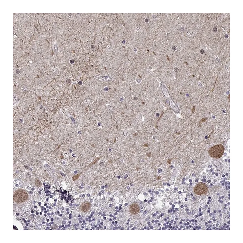 Atlas Antibodies Anti-EIF4E1B Antibody