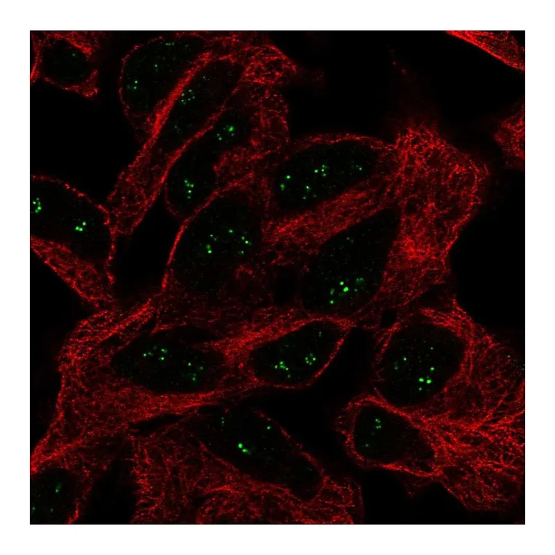 Atlas Antibodies Anti-EIF4E3 Antibody