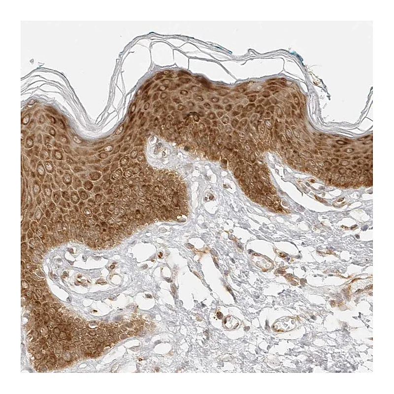 Atlas Antibodies Anti-EIF4G1 Antibody