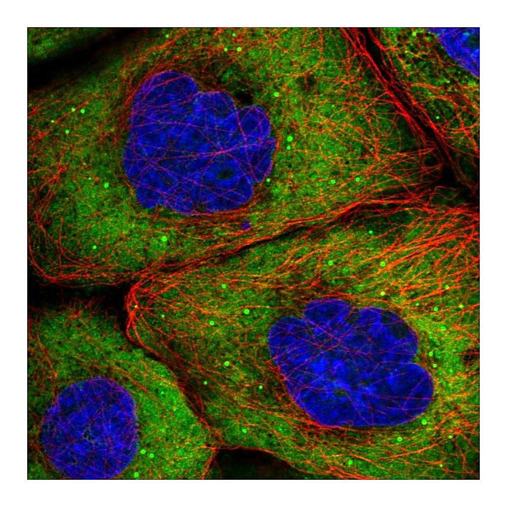 Atlas Antibodies Anti-EIF4G1 Antibody