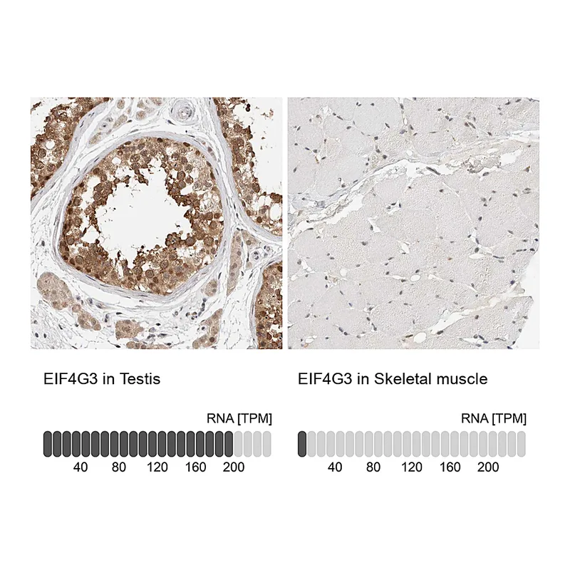 Atlas Antibodies Anti-EIF4G3 Antibody