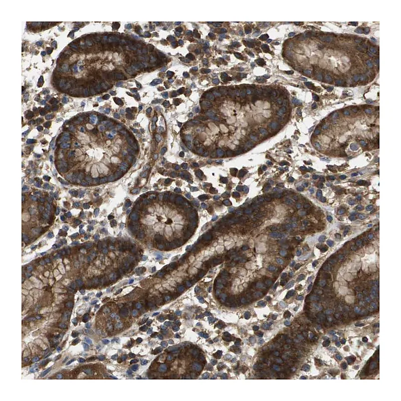 Atlas Antibodies Anti-EIF4G2 Antibody