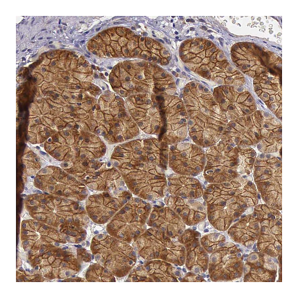 Atlas Antibodies Anti-EIF5 Antibody