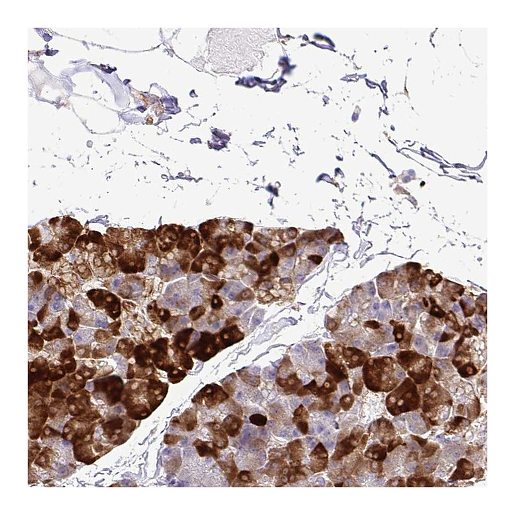 Atlas Antibodies Anti-EIF5A Antibody