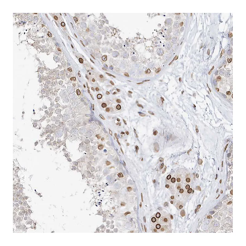Atlas Antibodies Anti-EIF5A2 Antibody
