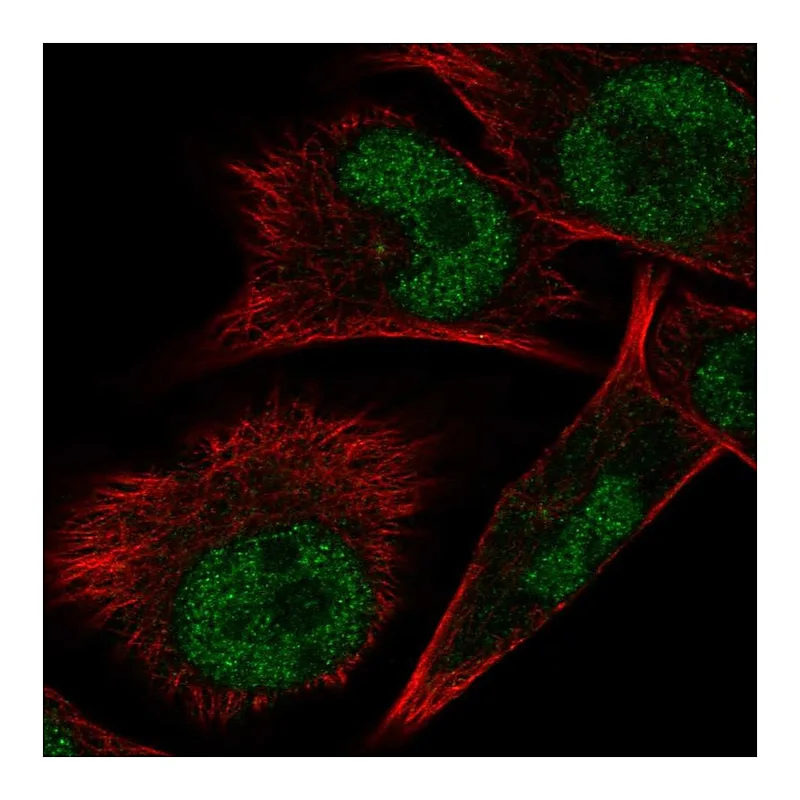 Atlas Antibodies Anti-ELAC1 Antibody