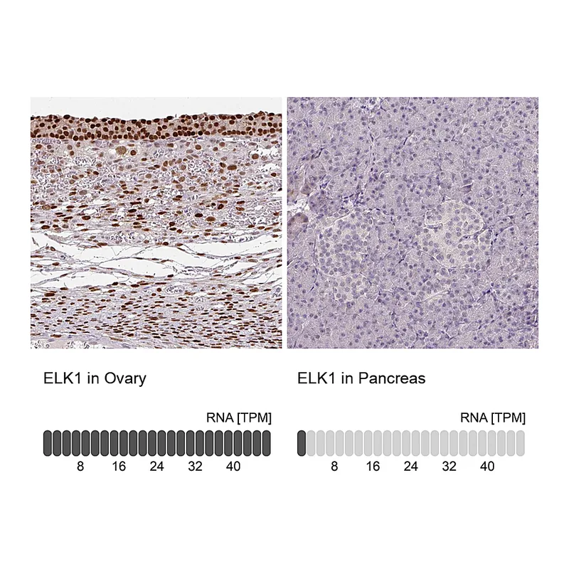Atlas Antibodies Anti-ELK1 Antibody
