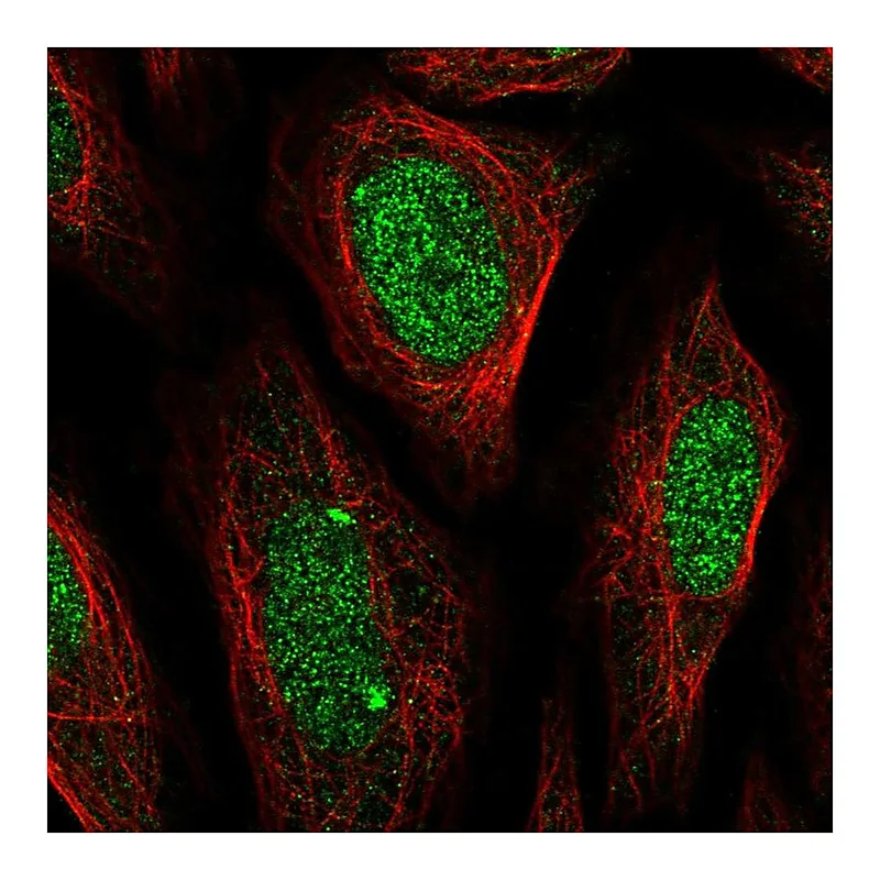 Atlas Antibodies Anti-ELK1 Antibody