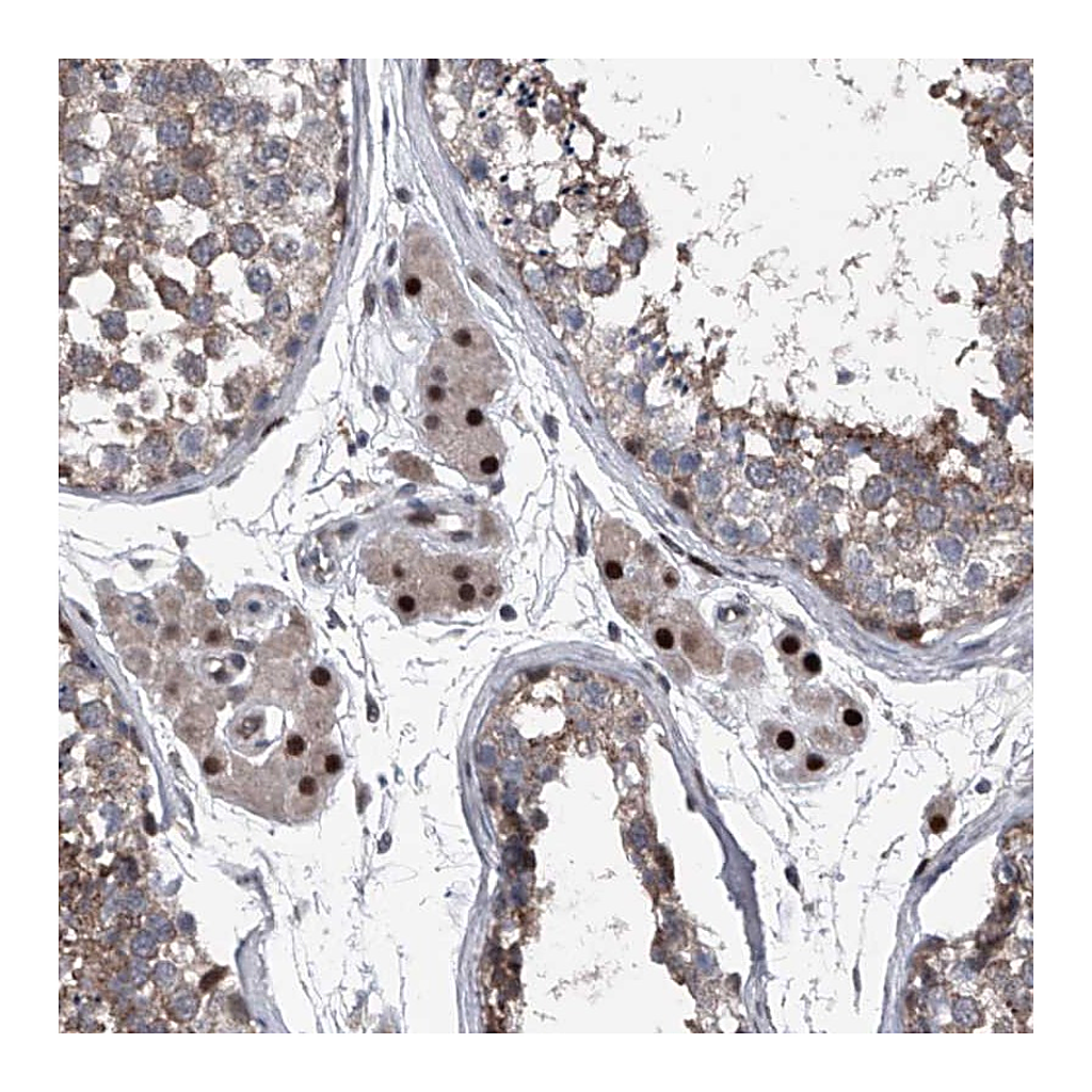Atlas Antibodies Anti-ELK4 Antibody
