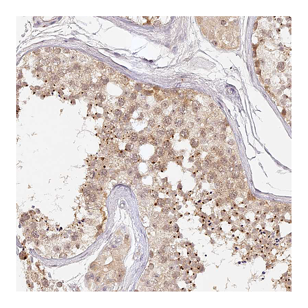 Atlas Antibodies Anti-ELL3 Antibody