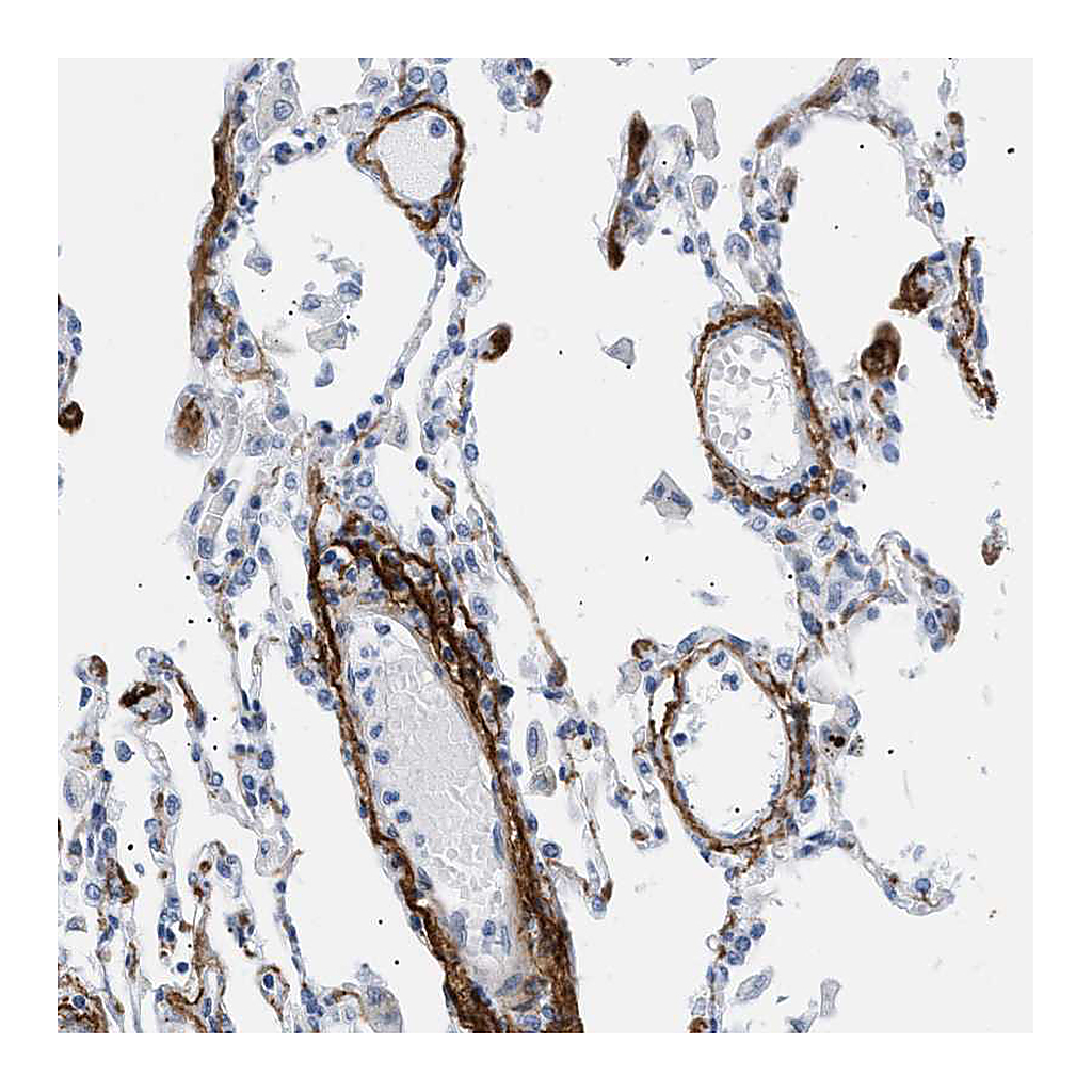 Atlas Antibodies Anti-ELN Antibody