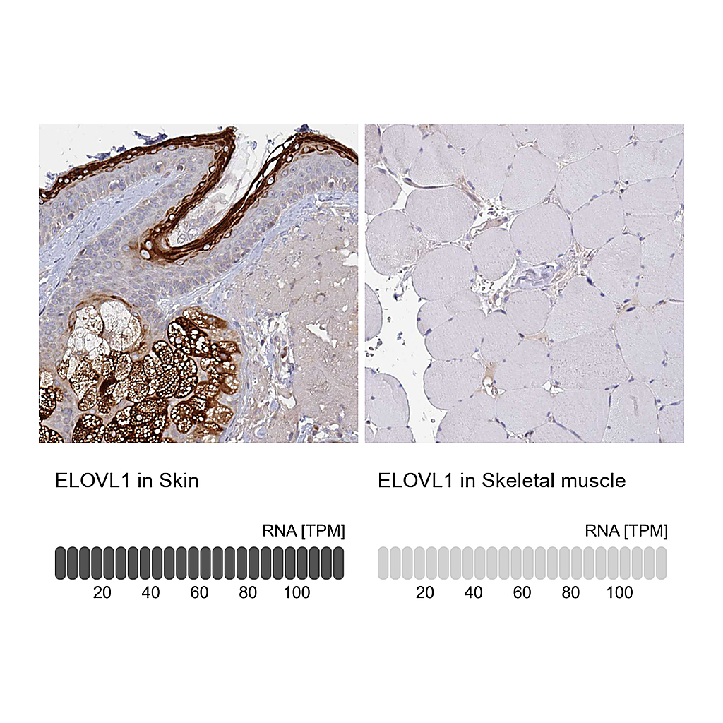Atlas Antibodies Anti-ELOVL1 Antibody