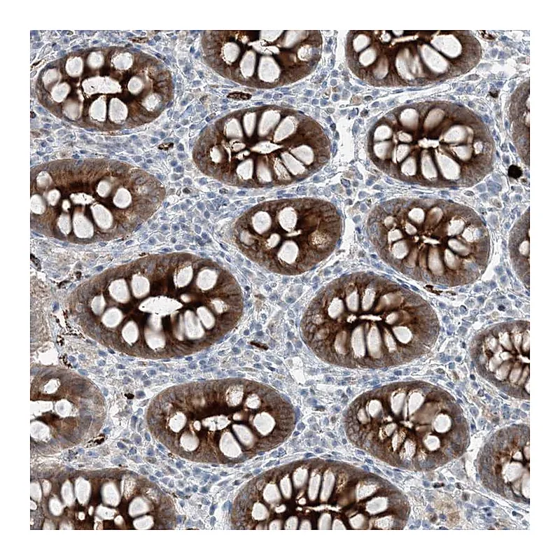 Atlas Antibodies Anti-ELOVL7 Antibody