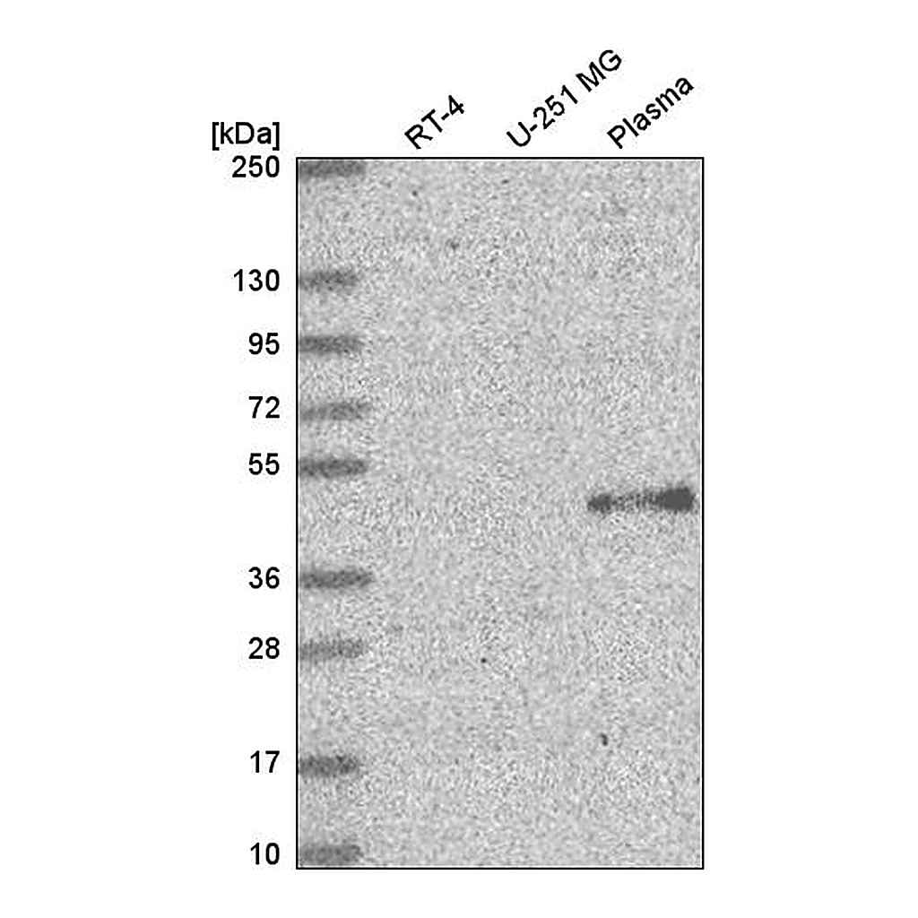 Atlas Antibodies Anti-ELOVL5 Antibody
