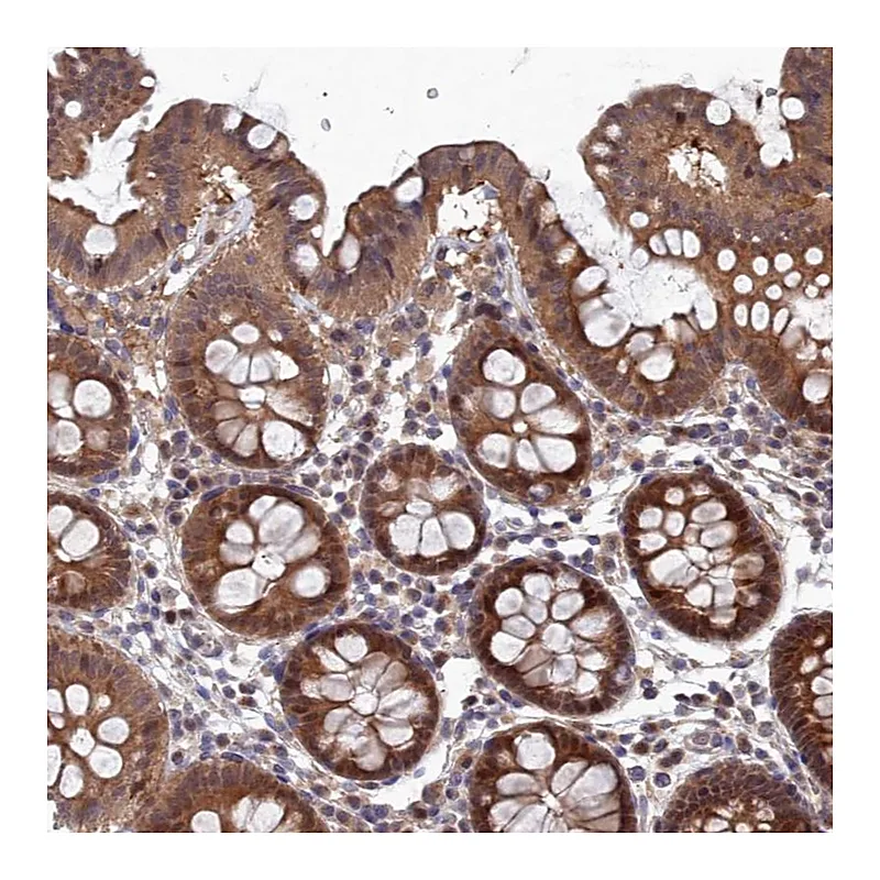 Atlas Antibodies Anti-ELOVL6 Antibody