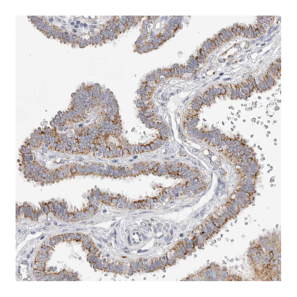 Atlas Antibodies Anti-ELP3 Antibody