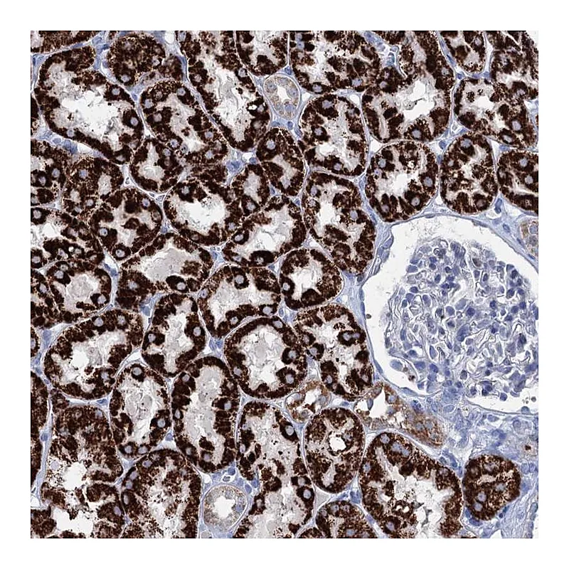 Atlas Antibodies Anti-ELP4 Antibody