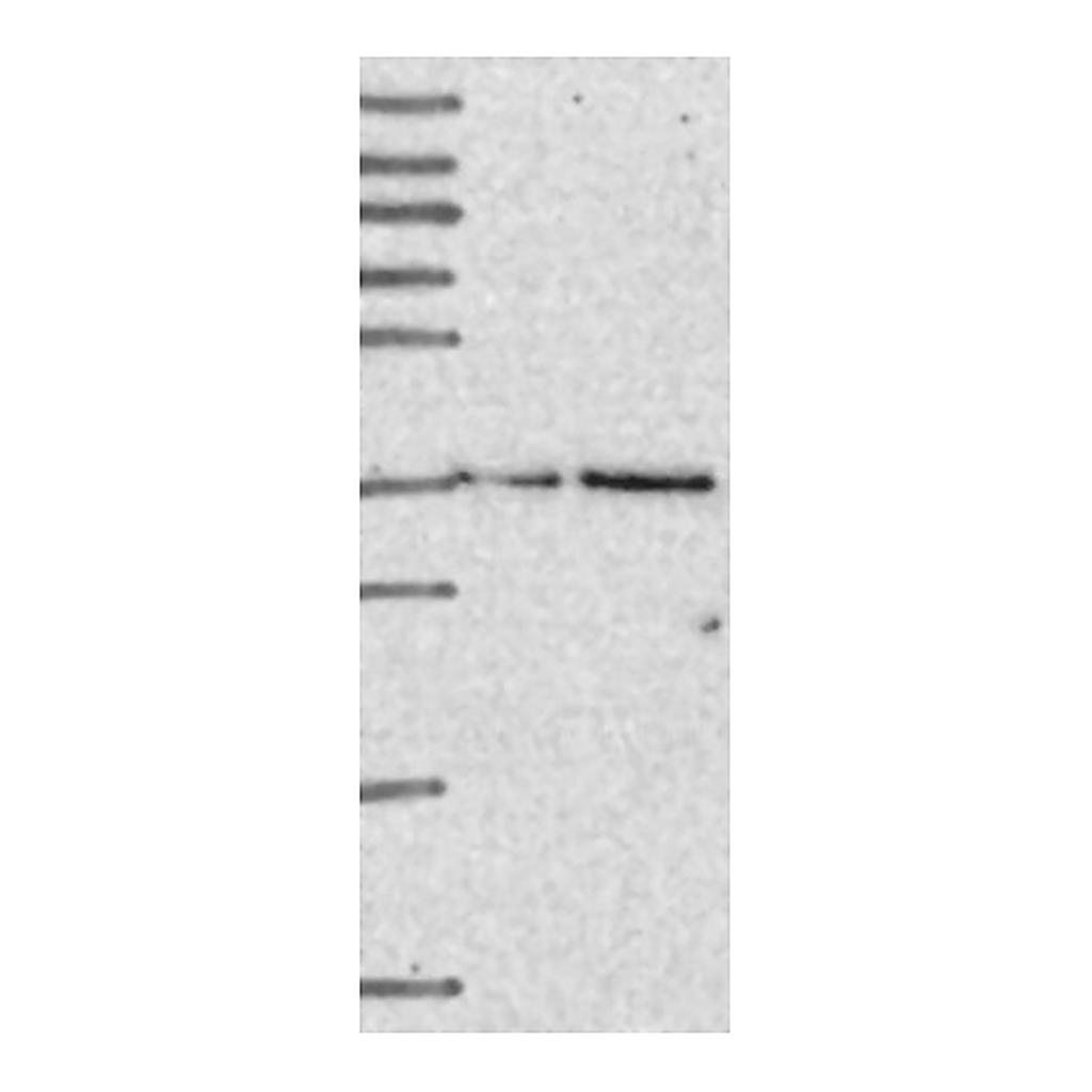 Atlas Antibodies Anti-ELP5 Antibody