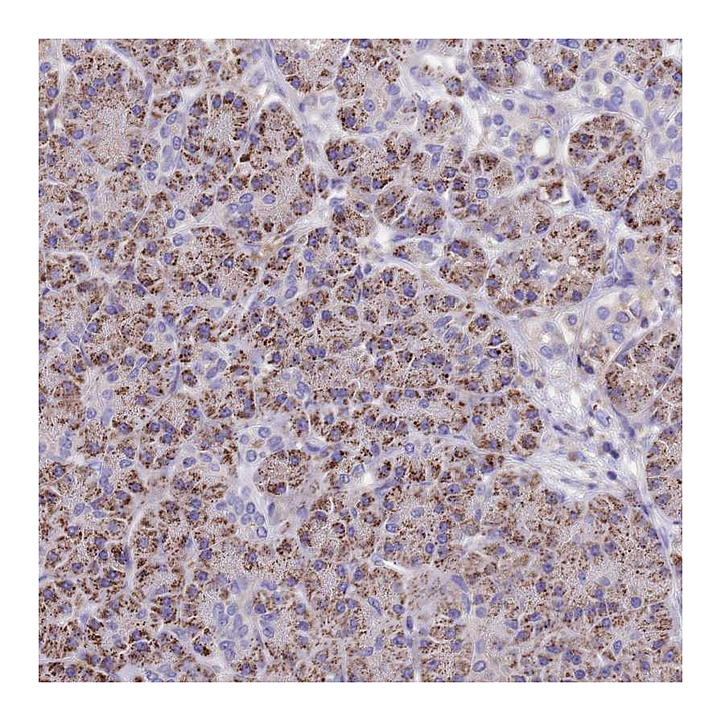Atlas Antibodies Anti-ELP6 Antibody