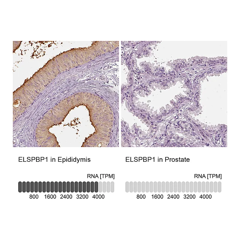 Atlas Antibodies Anti-ELSPBP1 Antibody