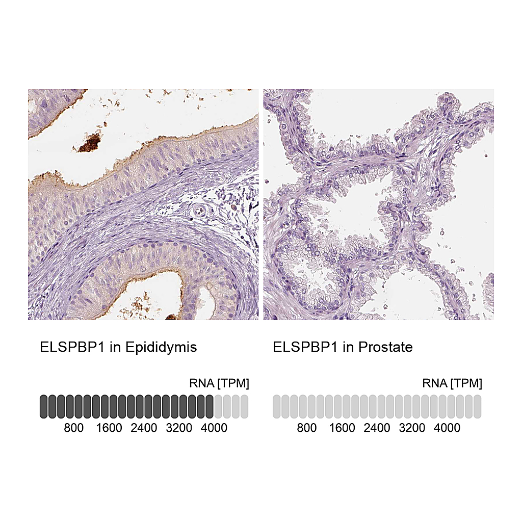 Atlas Antibodies Anti-ELSPBP1 Antibody