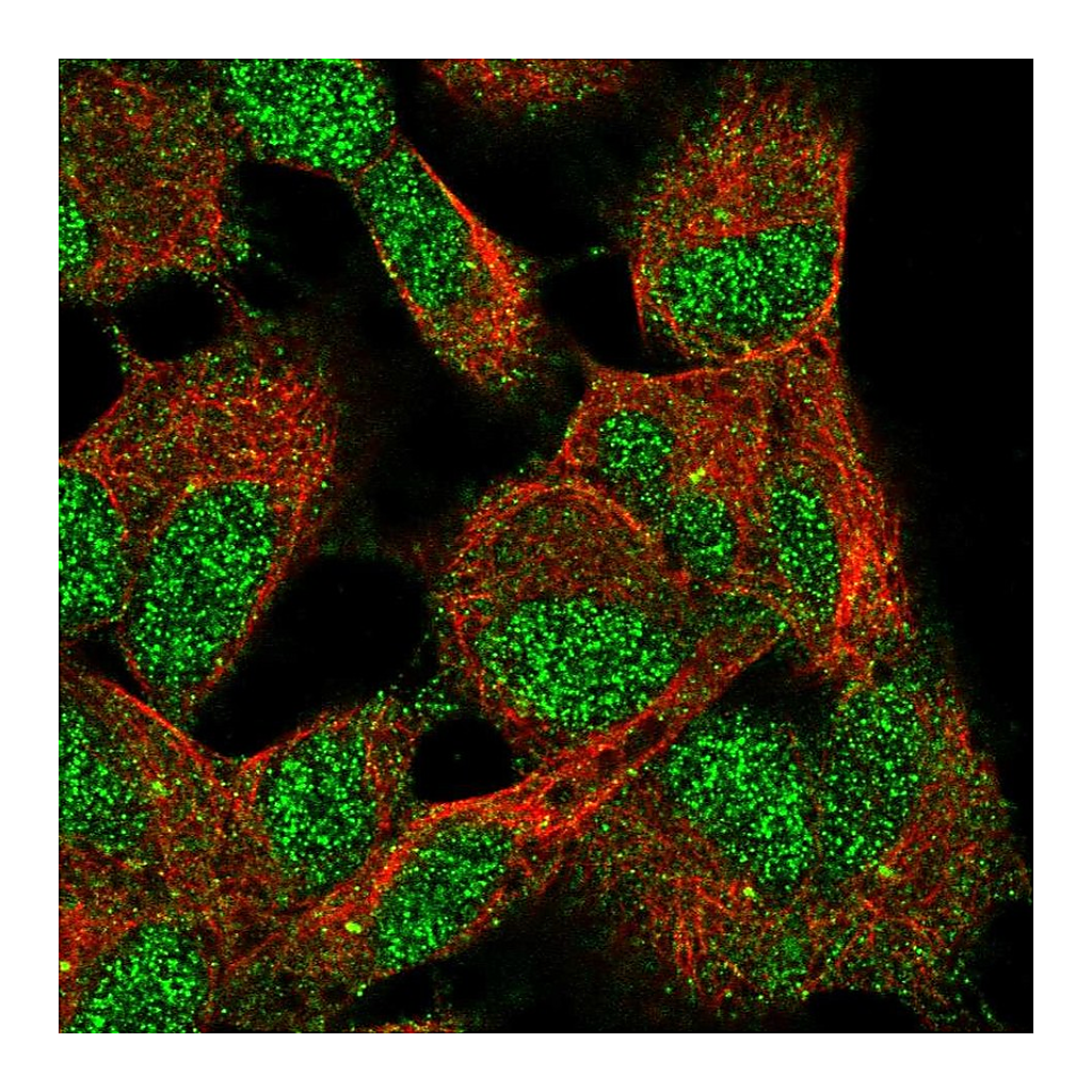 Atlas Antibodies Anti-ELP6 Antibody