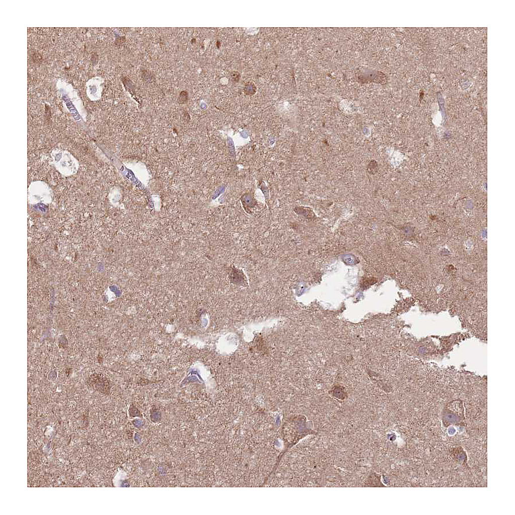 Atlas Antibodies Anti-EMC1 Antibody