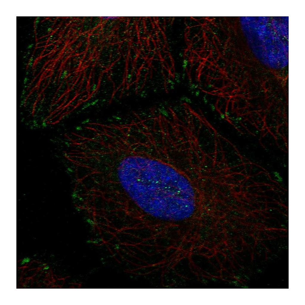 Atlas Antibodies Anti-EMC4 Antibody