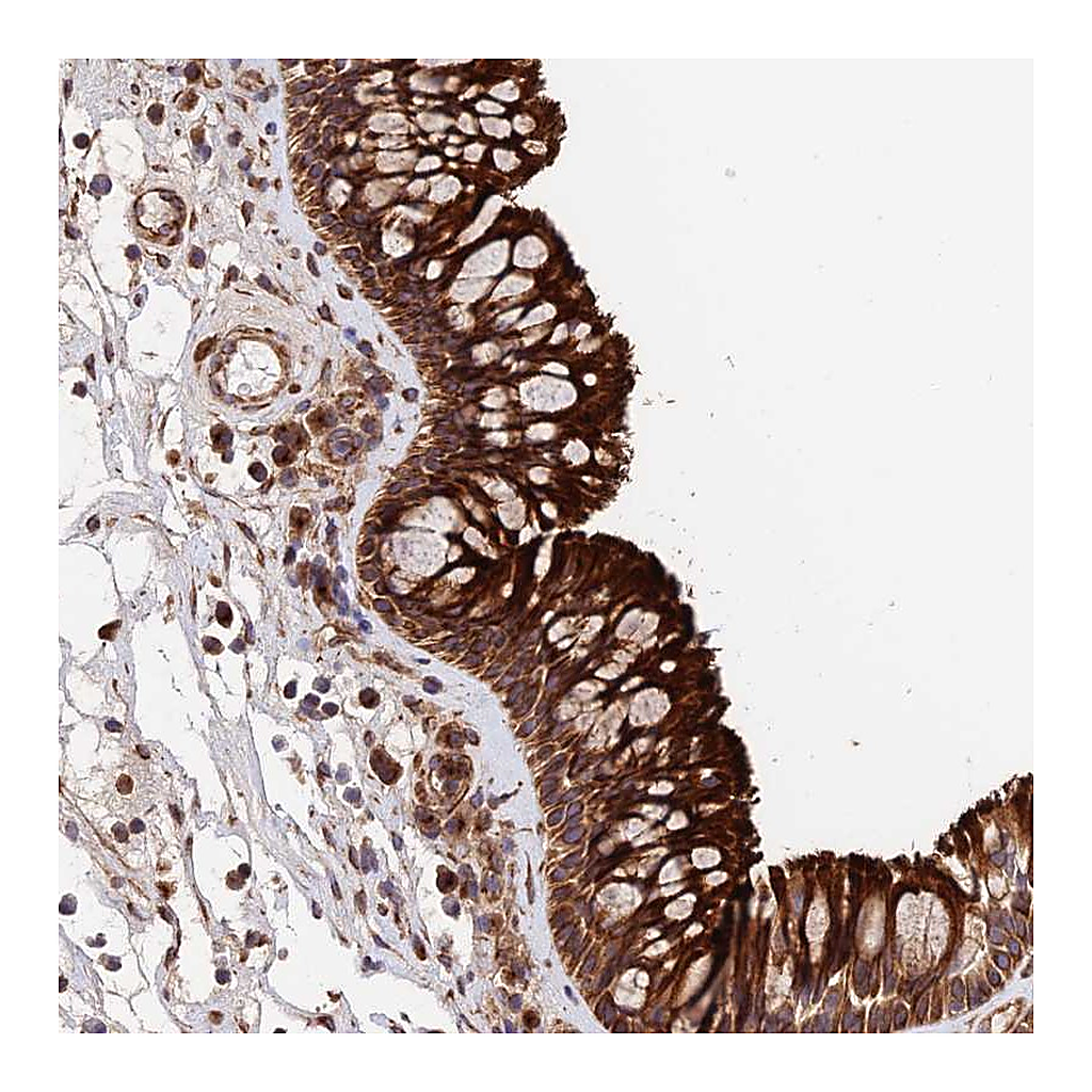 Atlas Antibodies Anti-EMC3 Antibody