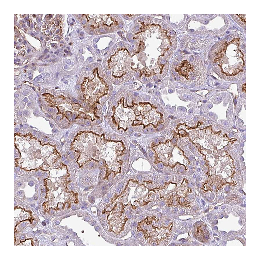 Atlas Antibodies Anti-EME2 Antibody