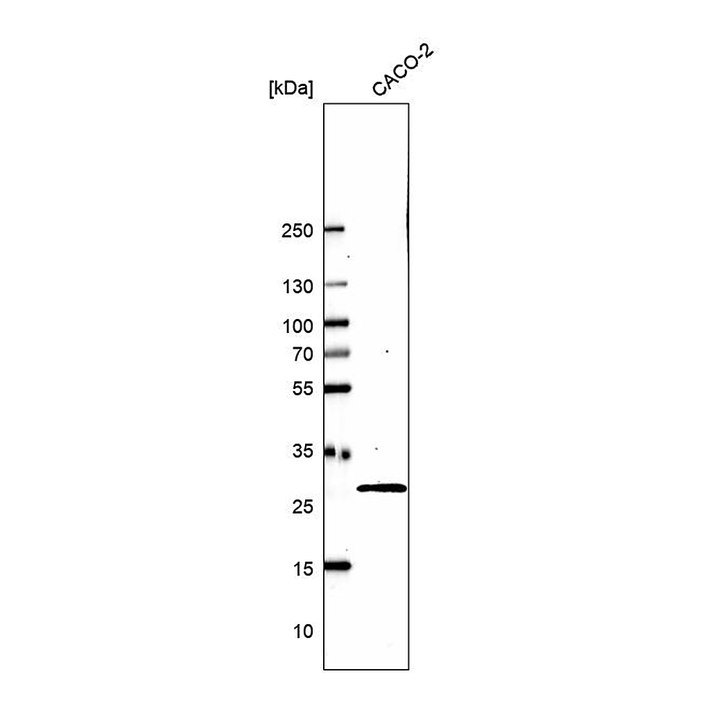 Atlas Antibodies Anti-EMG1 Antibody
