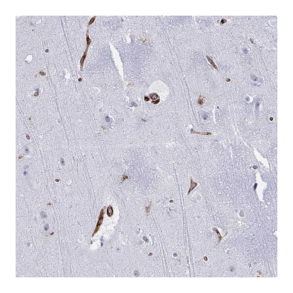 Atlas Antibodies Anti-EML1 Antibody