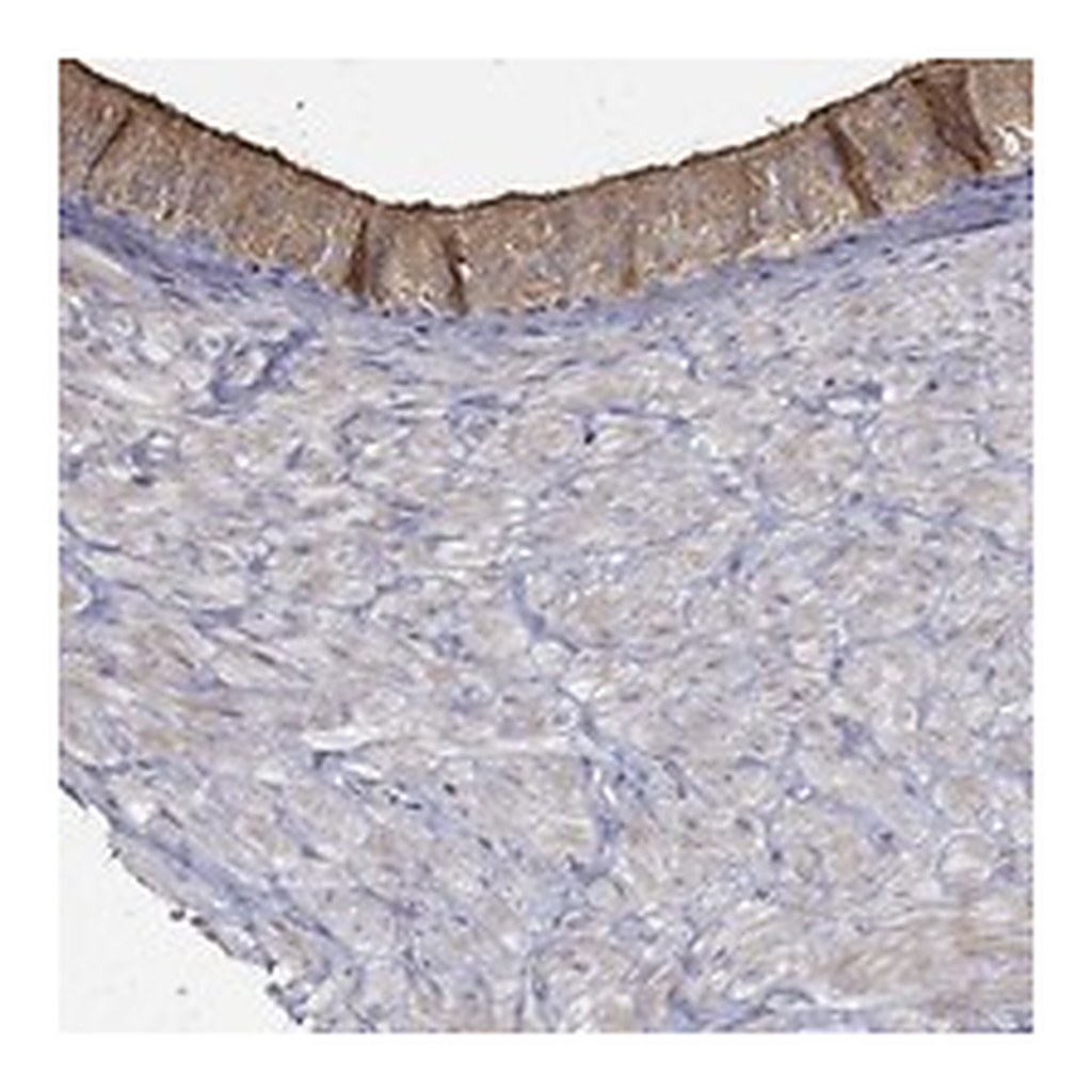 Atlas Antibodies Anti-EMILIN3 Antibody