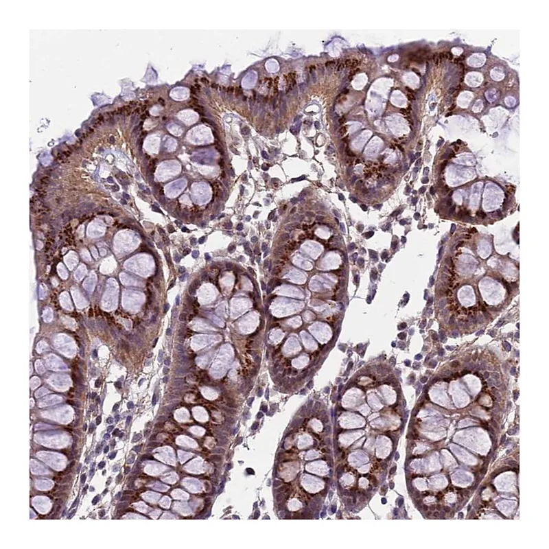 Atlas Antibodies Anti-EMILIN3 Antibody