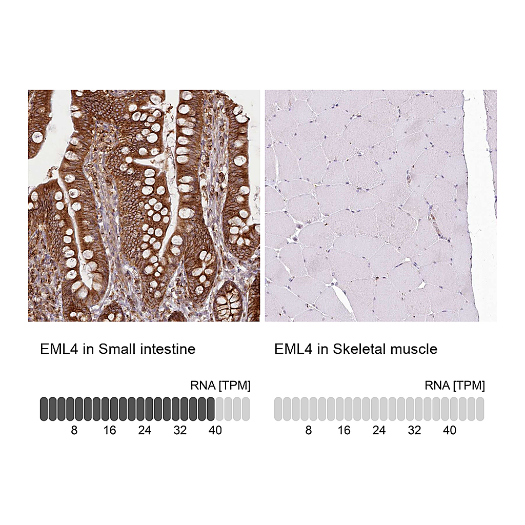 Atlas Antibodies Anti-EML4 Antibody