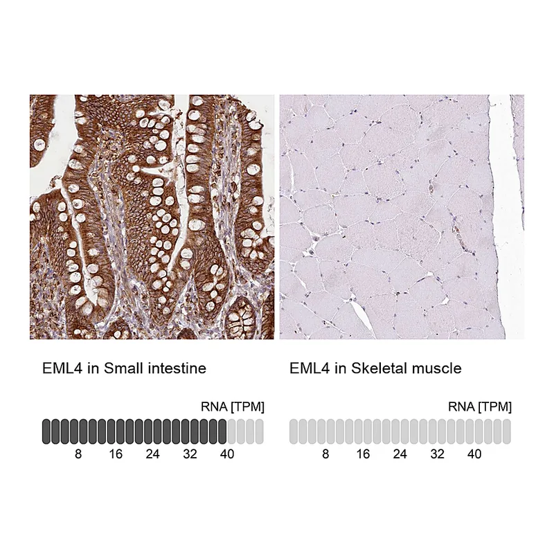 Atlas Antibodies Anti-EML4 Antibody