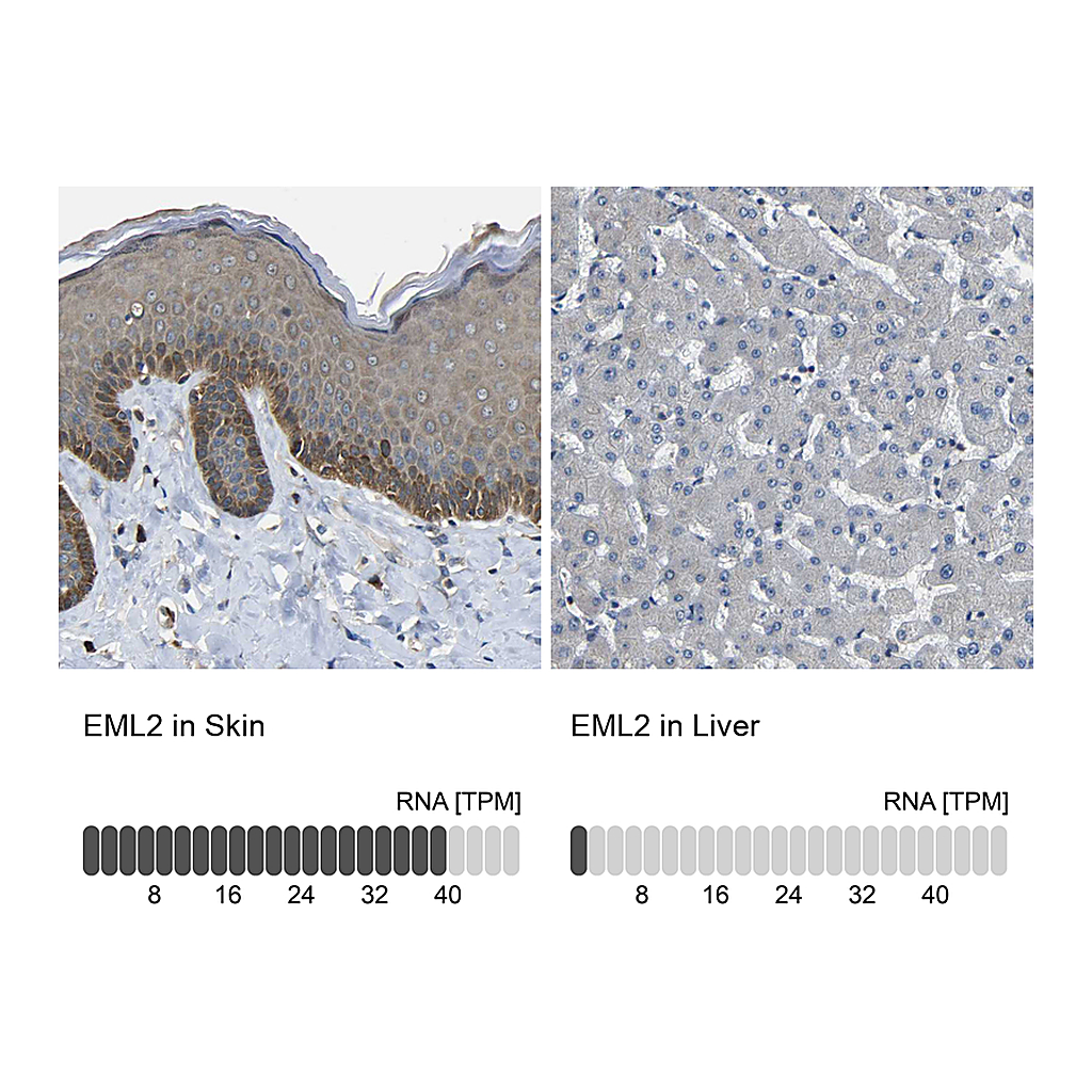 Atlas Antibodies Anti-EML2 Antibody