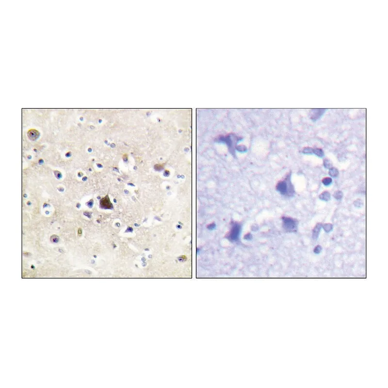 Merck Anti-GR antibody produced in rabbit