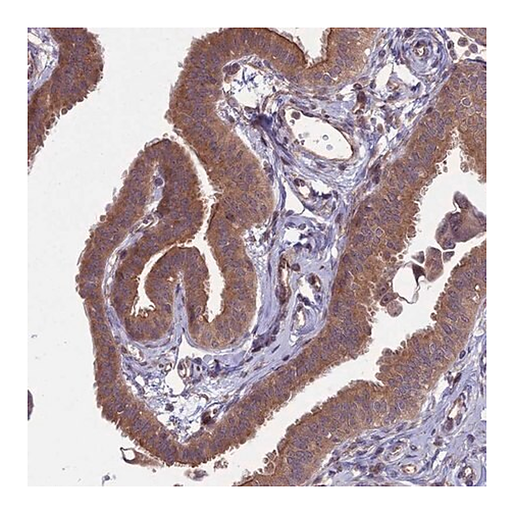 Merck Anti-MFSD8 antibody produced in rabbit